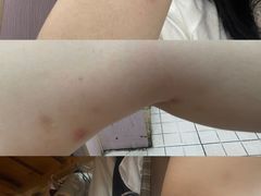 -复旦大学附属华山医院(总院)