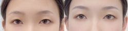 -久匠·纹眉纹绣半永久