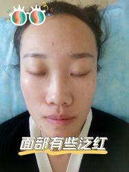 体验前-北京爱育华医院-医疗美容科