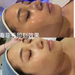 -安吉拉青春化管理中心