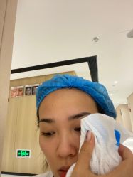 体验后-广东韩妃整形外科医院