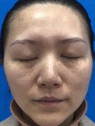 体验前-上海锦妍医疗美容门诊部