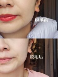 -植蔻妍倍儿专业脱毛·皮肤管理