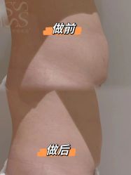 -Fundi张玉珊修身堂·indiba·BTL科技瘦身