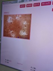 -凡碧诗毛孔清洁收细