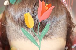 -大麦微针植发全国连锁