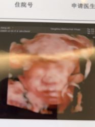 -杭州贝瑞斯美华妇儿医院·早孕·产检·儿科