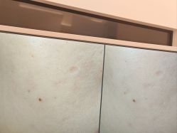 -苑苑vbeauty科技美容SPA