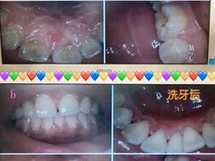 -爱齿尔口腔美学种植中心(永清院)