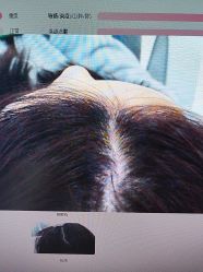 -雍禾植发全国连锁