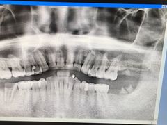 -上海市杨浦区牙病防治所