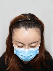 -大麦微针植发全国连锁