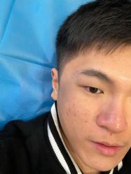 体验前-郑荃丽格医疗美容