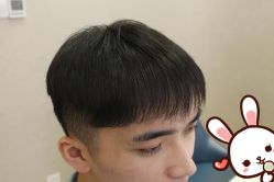 点击看大图 -大麦微针植发丨全国连锁