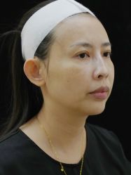 点击看大图 -Yestar重庆艺星医疗美容医院