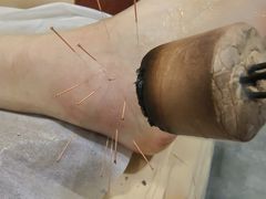 -手功夫·月明中医诊所·正骨推拿艾灸