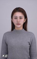 -Yestar重庆艺星医疗美容医院
