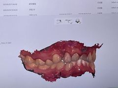 -华颜美口腔矫正·种植牙