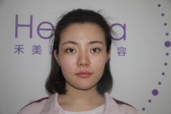 点击看大图 -禾美嘉医疗美容