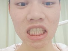 -团圆口腔·种植中心(锦江院区)