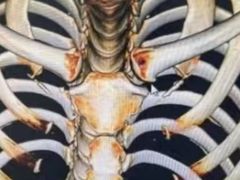 -上海市第五人民医院