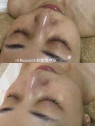 点击看大图 -Hi Beauty Skin 科技美肤中心
