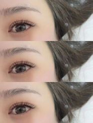 -U-Nail