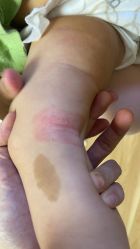 -首都儿科研究所附属儿童医院