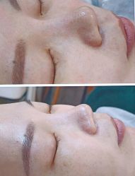 -SKIN79皮肤管理中心