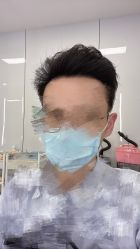 -大麦微针植发丨全国连锁