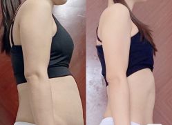 -Lily纤美·科技减脂中心