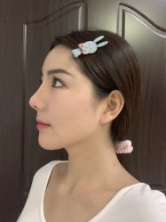 体验后-禾美嘉医疗美容