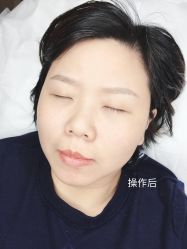 -西施无菌半永久纹绣眉眼影唇轻增发纹发际线