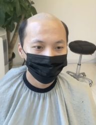 -发饰美男士增发补发假发定制店