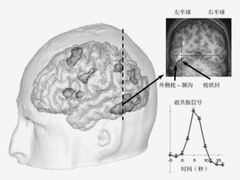 -多特儿童专注力·感统训练·注意力提升培训(锦峰训练中心)