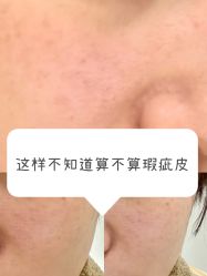 体验前-亿美医疗美容·半岛大超炮官方授权店