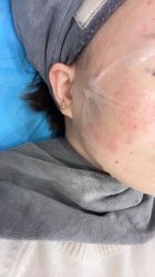 -北京润美玉之光医疗美容