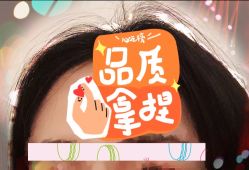 -大麦微针植发全国连锁