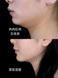 -克丽缇娜