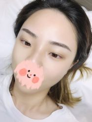-MIVI半永久纹眉绣眉