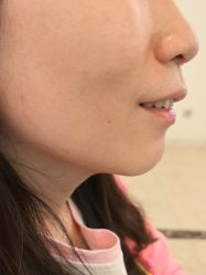 -长沙雅美医疗美容医院