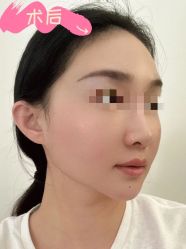 -素美医疗美容·西南眼鼻整形·修复基地