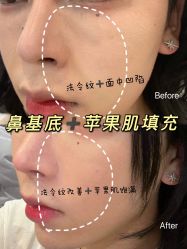 -Yestar宁波艺星整形医院