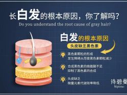 -诗碧曼·头疗养发馆