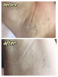 -植蔻妍倍儿专业脱毛·皮肤管理