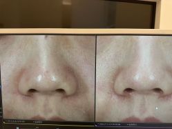 -苑苑vbeauty科技美容SPA