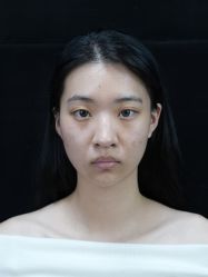 点击看大图 -Yestar宁波艺星整形医院