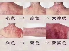 -裕和堂中医推拿艾灸(太古汇臻品店)