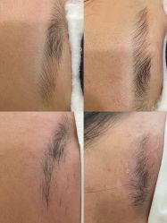 -变美丽半永久纹眉连锁·机器野生眉•洗眉
