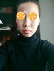 体验前-北京炫美医疗美容